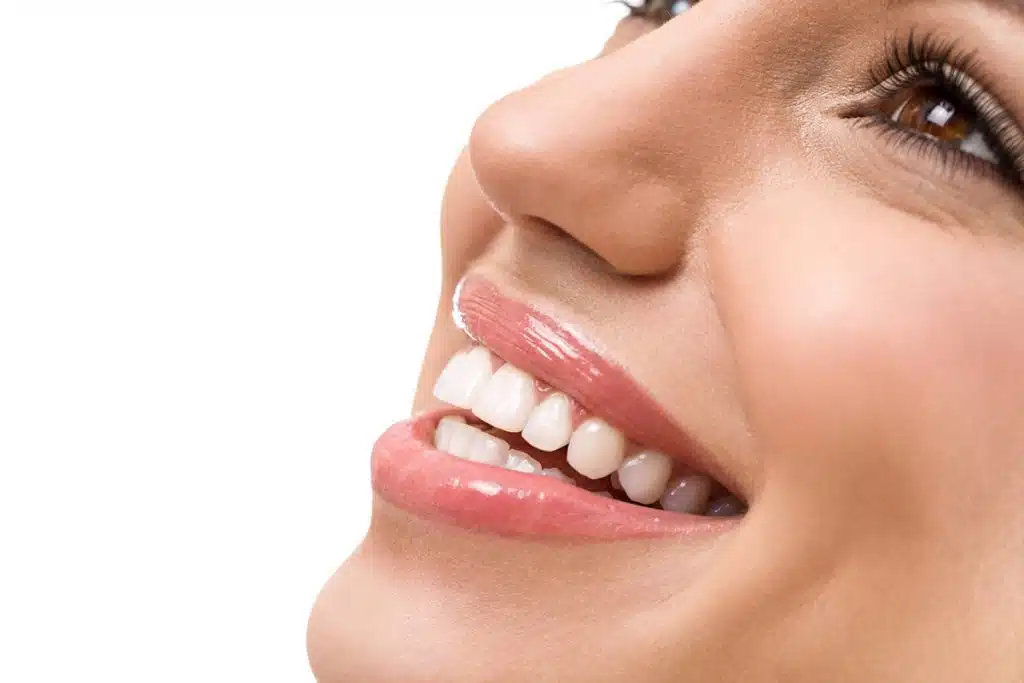 How Do Dental Veneers Work