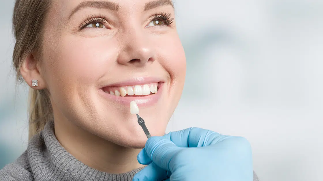 Composite fillings