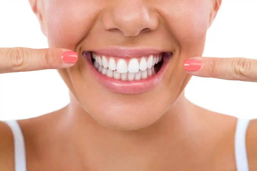 Teeth Whitening at the Dentist vs. At-Home Kits: What Works Best?